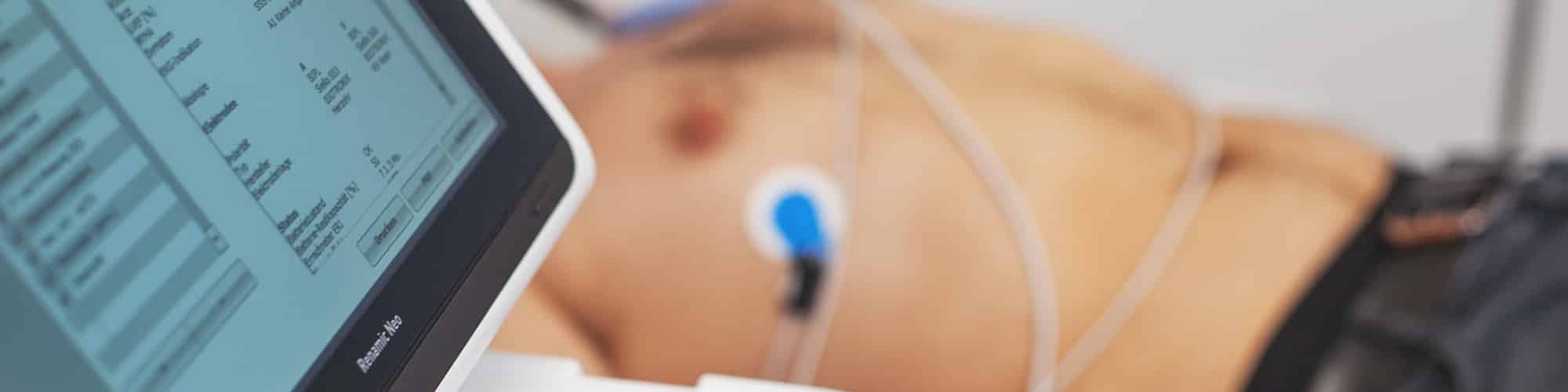 EKG-Monitoring-Kardiologie-Münster-Herzuntersuchung Ein Patient in Münster wird während einer EKG-Untersuchung kardiologisch überwacht.
